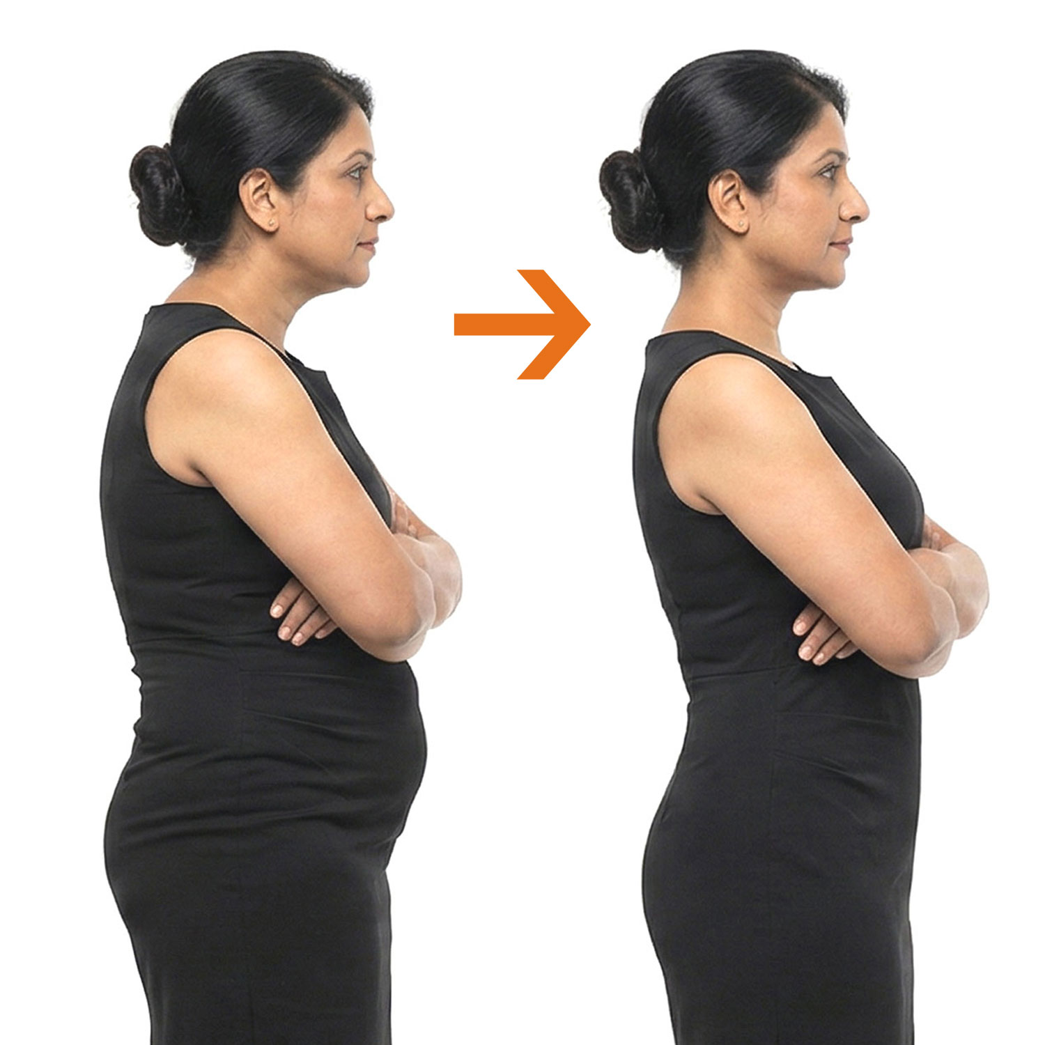 Image 3 of Tummy Tucker